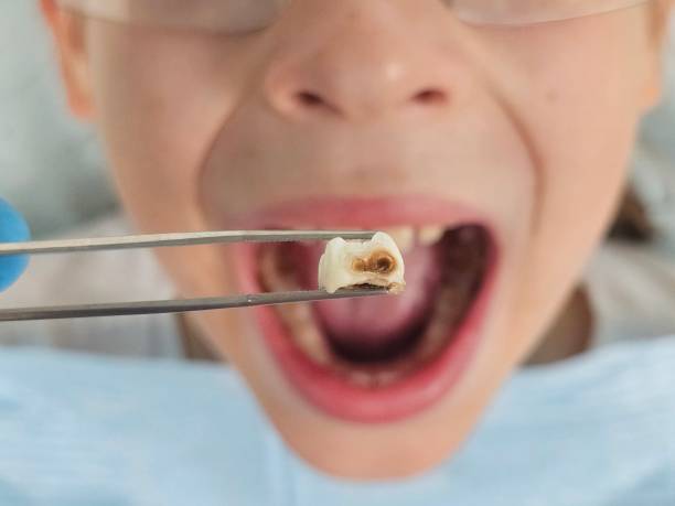 Best Urgent Care for Lost Fillings or Crowns in Grifton, NC